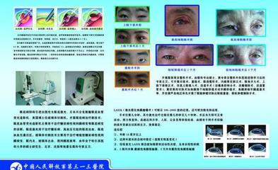 醫(yī)院眼科圖版圖片PSD源文件免費下載(圖片編號:3281535)_六圖網(wǎng)16pic.com